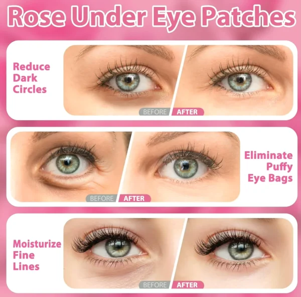 Pink Eye Mask - Dark Circles