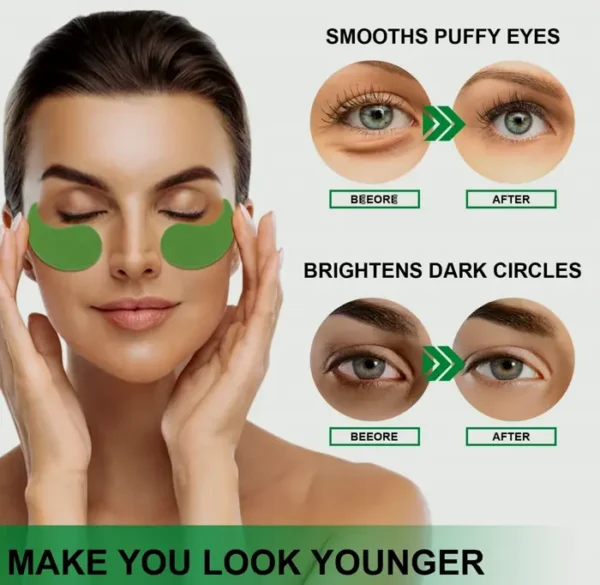 Underneath Eyes Patches for Reducing Dark Circles, Edema, and Puffiness